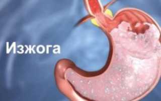 Почему пучит живот у женщин: причины и советы