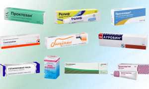 Кремы, эффективные при геморрое: советы и рекомендации