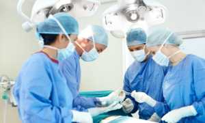 Причины отрыжки воздухом после еды, лечение и профилактика