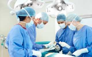 Причины отрыжки воздухом после еды, лечение и профилактика