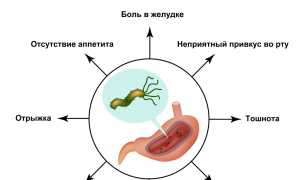 Хеликобактер пилори: что это, как лечат и предотвращают