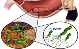 Творог в питании при гастрите: полезные свойства и рекомендации