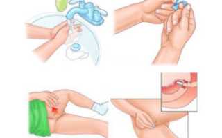 Свечи для лечения геморроя: эффективные методы и рекомендации