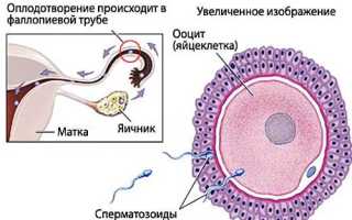 Понос как ранний признак беременности: важные аспекты и советы