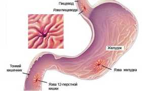 Гастроскопия для обследования желудка: важный шаг к здоровью