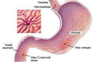 Гастроскопия для обследования желудка: важный шаг к здоровью