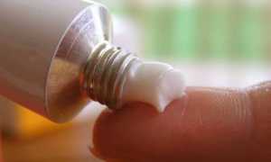 Мази от трещин при геморрое: эффективные решения для здоровья