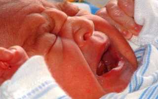 Лечение запоров у малышей на искусственном вскармливании: советы и рекомендации