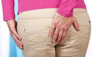 Лечение тромбоза геморроидального узла: эффективные методы и советы