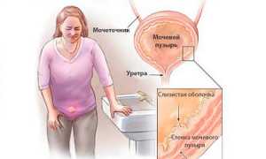 Неполное, нарушенное опорожнение мочевого пузыря: причины и последствия