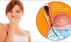 Как выявить язву желудка в домашних условиях быстро и эффективно