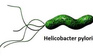 Гастрит острый: симптомы и лечение