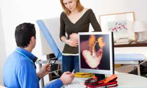 Язва желудка и 12-перстной кишки: лечение и профилактика