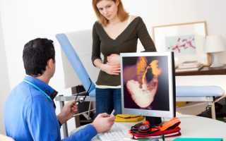 Язва желудка и 12-перстной кишки: лечение и профилактика