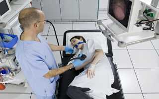 Гастроскопия без боли: комфортная процедура для здоровья