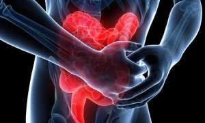 Непроходимость кишечника: причины и лечение