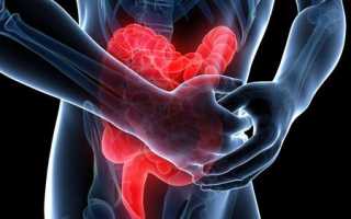 Непроходимость кишечника: причины и лечение