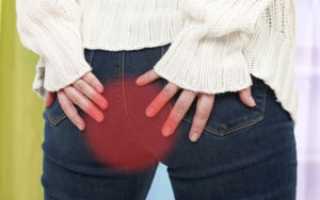 Свечи против геморроя эффективные и недорогие для быстрого облегчения