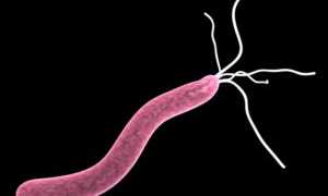 Бактерия, провоцирующая язву желудка: причины и последствия