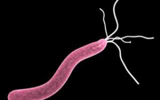 Бактерия, провоцирующая язву желудка: причины и последствия