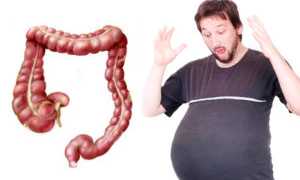 Причины газов и пучения живота: что нужно знать