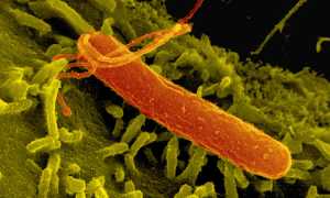 Симптомы гастрита и их проявления