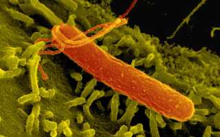 Симптомы гастрита и их проявления