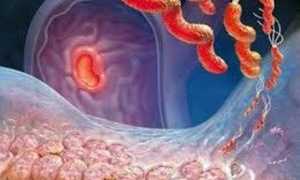 Эрозивная форма гастрита: причины и лечение