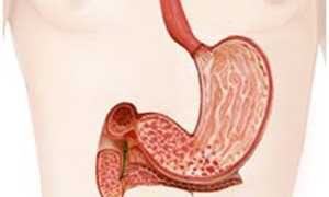 Лечение эрозивного гастрита народными средствами в домашних условиях