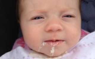 Ребенок срыгивает после кормления свернувшимся молоком: причины и рекомендации