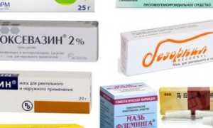 Чем и как лечить геморрой женщинам в домашних условиях