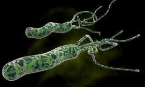 Тошнота на фоне гастрита: причины и лечение