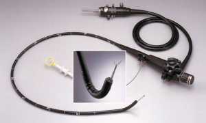 Как часто можно проходить ФГДС для здоровья?