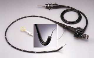 Как часто можно проходить ФГДС для здоровья?