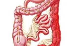 Понос к кровью: причины и лечение