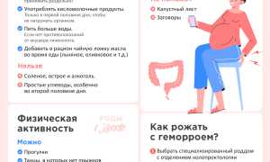 Симптомы геморроя при беременности: что нужно знать