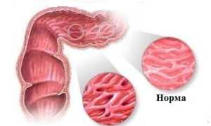 Понос белого цвета: причины и лечение