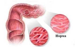 Понос белого цвета: причины и лечение