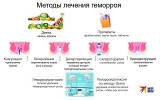 Методы и средства лечения геморроя: эффективные подходы и рекомендации