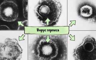 Гастрит аутоиммунный: причины и лечение