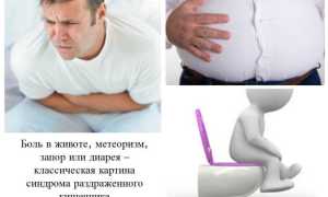 Лечение СРК с сопутствующей диареей: эффективные методы и рекомендации