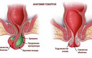 Проктолекс от геморроя: эффективное средство для лечения