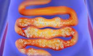 Антибиотики для лечения язвы желудка: эффективные методы и рекомендации