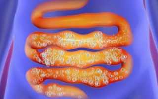 Антибиотики для лечения язвы желудка: эффективные методы и рекомендации