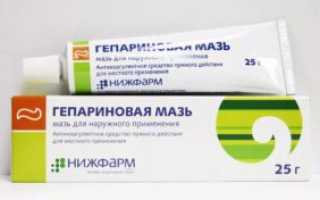 Симптомы острого геморроя: что нужно знать