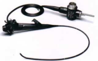 Как готовиться к гастроскопии: полезные советы и рекомендации