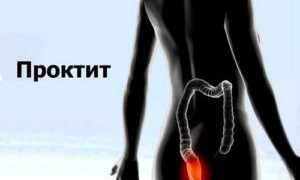 Свечи с облепихой от геморроя: эффективное средство для лечения