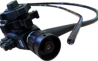 Гастроскопия без заглатывания зонда: современный подход к диагностике