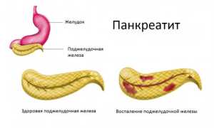 Частые позывы к совершению дефекации: причины и рекомендации