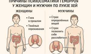 Причины появления геморроя у женщин: важные аспекты здоровья
